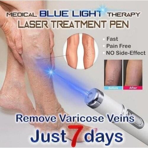 1pc Blue Light Therapy Pen Varicose Veins Treatment Soft Scar Wrinkle Removal Treatment Scar Acne Just 7 Days
