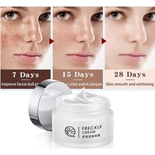 LAIKOU Pure Whitening Freckle Facial Cream Repair Remove Melasma Acne Spots Pigment Melanin Dark Spots Skin Brightening Cream