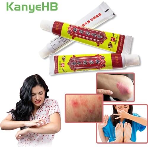1pcs Tinea Ointment Feet Rotten Peeling Itching Psoriasis Foot Erosive Beriberi Cream Feet Corn Cream Pain Relief Plaster S009
