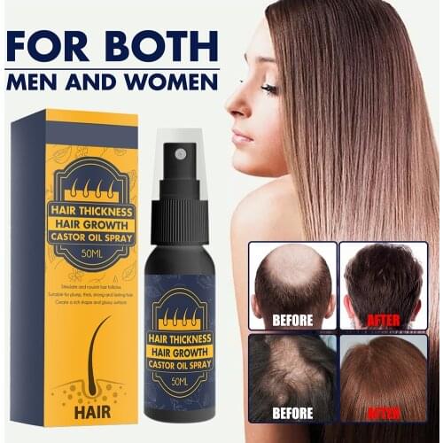 Hair Growth Spray Strong Hair Growth Liquid Moisturizing Growth Spray Hair Loss Castor Oil Eyebrows Eyelashes Beards Spray