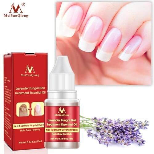 Fungal Nail Repair Essence Serum Anti Infection Paronychia Onychomycosis Treatment Care Foot Nail Fungus Removal Gel 10ML
