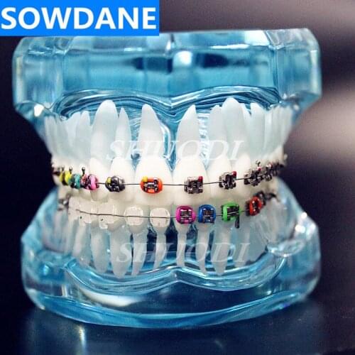 Dental Orthodontic Teeth Tooth Model with Ceramic and Metal Brackets for Patient Communication Dental Study Model