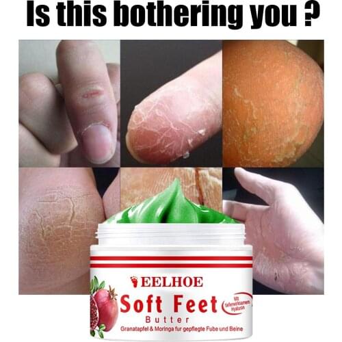 Moisturising Treatment Cream with Vitamin E for Hand Foot Anti-cracking Foot Cream for Dry Cracked Feet Heel Balm Daily