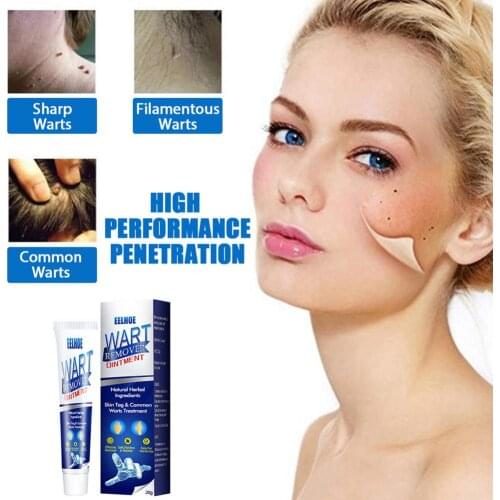 1pcs Body Wart Treatment Cream Removal Of Liquid Verruca Remedy Tags Moles Remover Anti Skin Removing From Warts