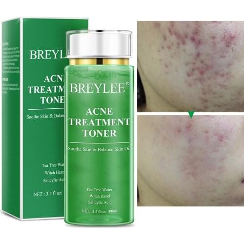 Tea Tree Acne Treatment Toner Facial Serum Skin Care Products Pore Minimizer Oil Control Makeup Water Face Toner Skin Care 100ml