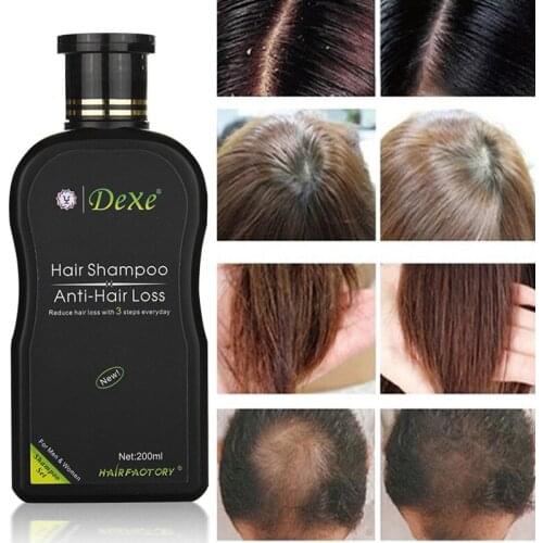 200ml Dexe Hair Shampoo Set Anti-hair Loss Chinese Herbal Hair Growth Product Prevent Hair Treatment For Men & Women