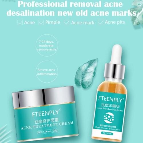 Acne Scar Removal Serum Acne Treatment Face Cream Fade Blain Imprint Shrink Pores Oil Control Moisturizing acne treatment
