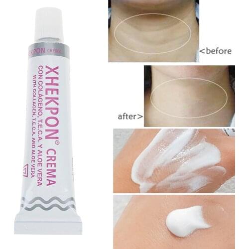 Women Anti Aging Whitening Cream Neck Cream Xhekpon Crema Face And Neck Cream 40ml Neckline Cream Wrinkle Smooth