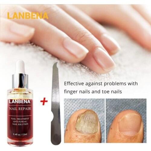 LANBENA 12ml Skin Care Nail Repair Serum Fungal Nail Treatment Remove Onychomycosis Nourishing Brighten Foot Care TSLM1