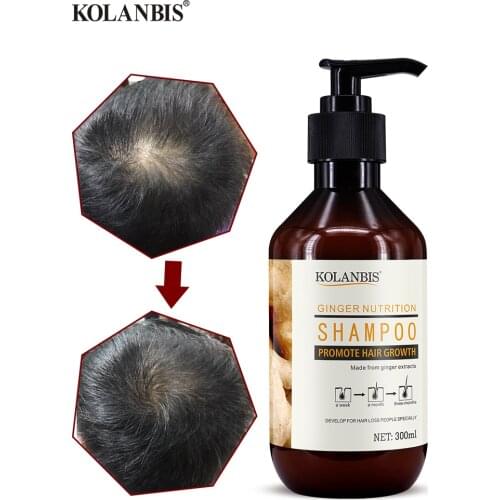 Hair Ginger Anti Thinning Shampoo Anti Dandruff Natural Growth Essence Fast Anti Hair Loss Products Oil Control Treatment