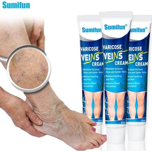 3pcs Varicose Veins Treatment Cream Varicosity Angiitis Removal Herbal Medical Plaster Vasculitis Phlebitis Spider Ointment 20g