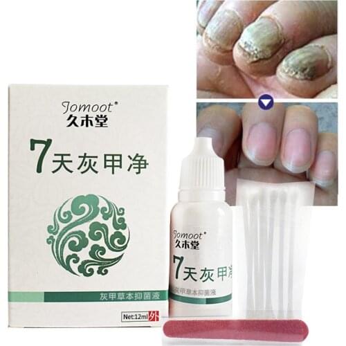 Toe Finger Nail Fungus Treatment Anti Fungal Infection with Cotton Swabs WH998