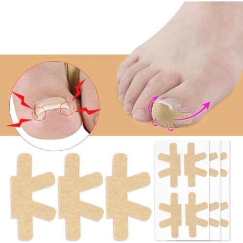 Professional Ingrown Toenail Foot Corrector Stickers Elasticity Toe Nail Care Pedicure Tools Health Care Protects Toe Nail