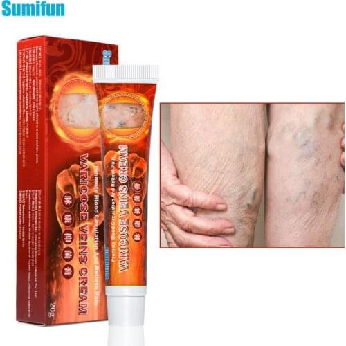 1Pcs Sumifun Varicose Veins Treatmentcream Varicosity Angiitis Remedy Pain Relief Ointment Herbal Medical Plaster Skin Care