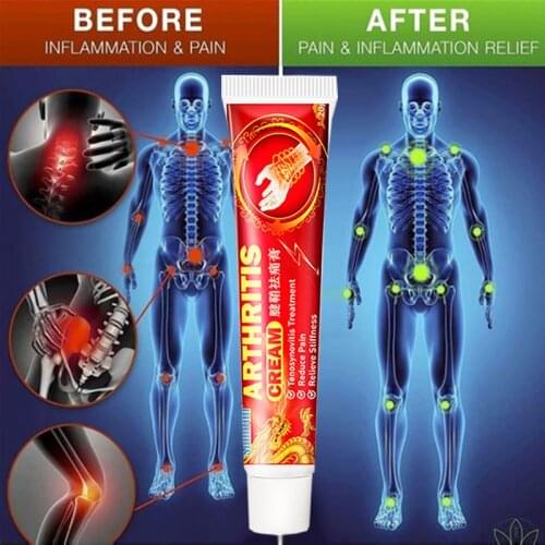 Powerful Efficient Relief Arthritis Cream Ointment Muscle Pain Headache Neuralgia Acid Stasis Rheumatism Arthritis Cream 1Pcs