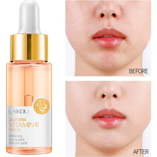 Face Care Serum Vitamina C Whitening Hidratante Anti Aging Wrinkle Acne Treatment Oil Control Facial Skin Care Beauty Products