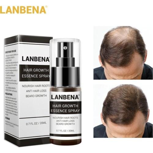LANBENA Hair Growth Essence Spray Product Preventing Baldness Consolidating Anti Hair Loss Nourish Roots Easy To Carry Hair Care