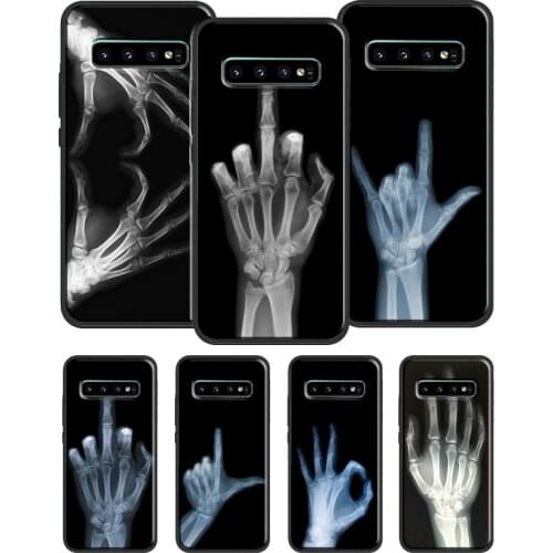 X-ray Hand Bones Case For Samsung Galaxy S10 S8 S9 Plus S20 FE S21 Ultra Note 20 Note9 Note 10 Plus Cover