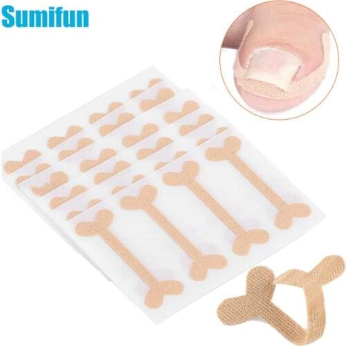 10/20pcs Ingrown Toenails Band Aid Pain Relief Paronychia Correction Sticker Repair Elastic Force Bandage Orthotics Toe Nail