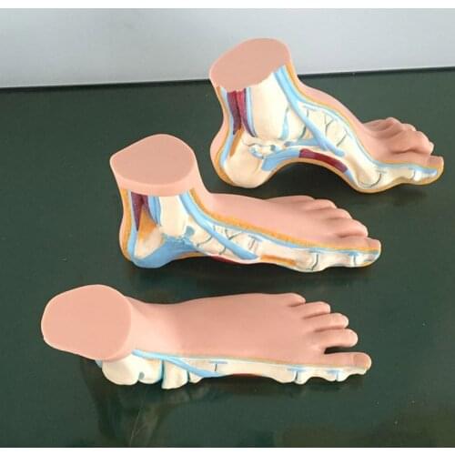 BIX-A1069 Normal Flat Foot Bow Model Medicine Student Medical Science Teaching Sources Supply