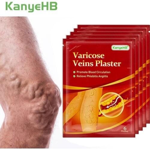 30pcs Herbal Varicose Veins Treatment Patch 100% Original Vasculitis Phlebitis Spider Varicosity Angiitis Medical Plaster A596