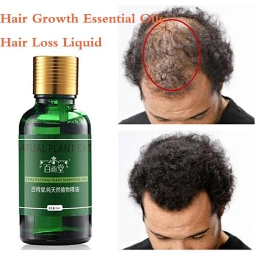 Anti Hair Loss Hair Growth Spray Essential Oil Liquid for Men Women Dry Hair Regeneration Repair Hair Loss Products
