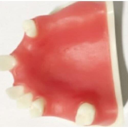 Dental Teeth Upper Jaw Model LY37 Dental Teeth Model Missing Teeth E Type