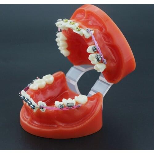 Orthodontic Model Dental Typodont w/h Metal Bracket Arch Wire Ligature Tie 30051