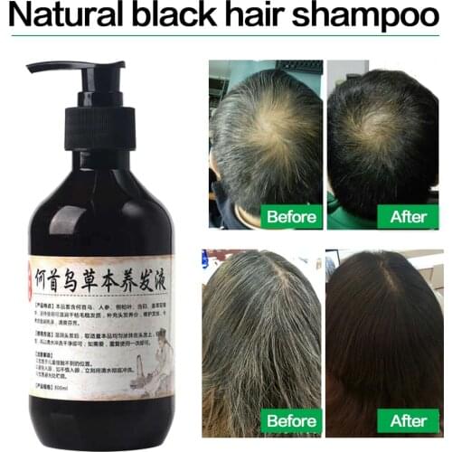 Herbal Natural Polygonum Multiflorum Shampoo Plant Liquid Grey Hair White Hair Removal Turn Permanent Black Hair Care 300ml