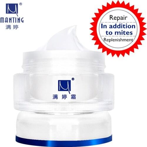 Manting Cream Mite Bug Busters Face Care Acne Treatment Scars Ance Remover Cream Removing Blain Refreshing Moisturizing Cream