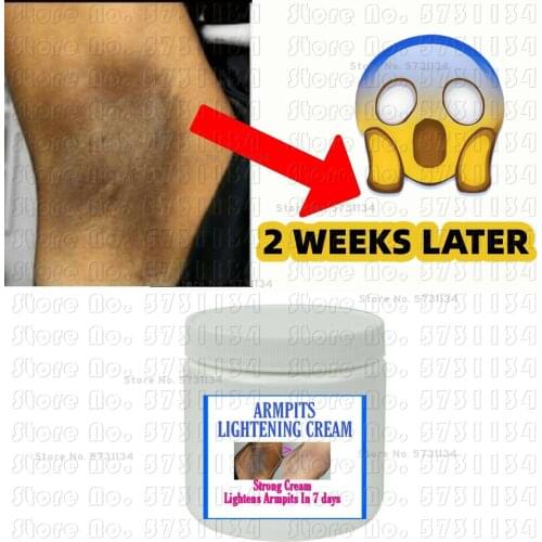 Skin Magical Body Underarm Armpit Elbow Dark Skin Legs Knee Repair Whitening Lightening Cream