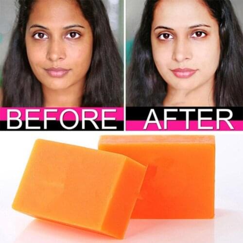 Dark Black Skin Lightening Soap Kojic Acid Whitening Soap Kojic Acid Glycerin Brighten Face Body Skin Bleaching Soap