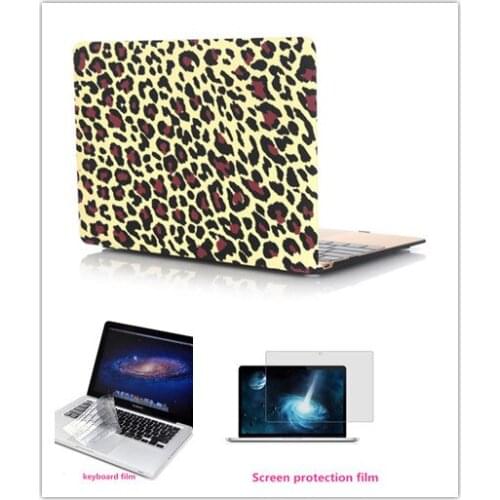 Free shipping 3 In 1 Water stick shell Hard Protective Case+Keyboard Film+Screen Protection Film for Macbook 12 inch Hot Sale