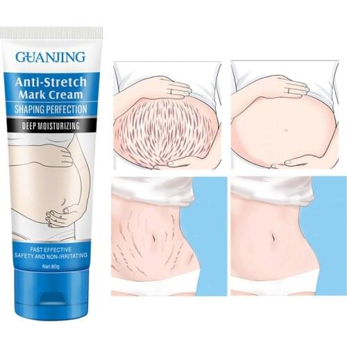 80g Stretch Mark Removes Cream Treatment Postpartum Obesity Pregnant Women Repair Anti-Aging Anti-Winkles Firming Body Cream