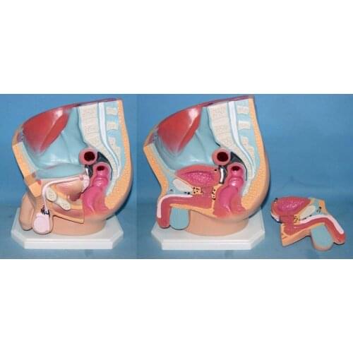 Men intraperitoneal Planning model Genital anatomy model Medical Teaching Aids free shipping