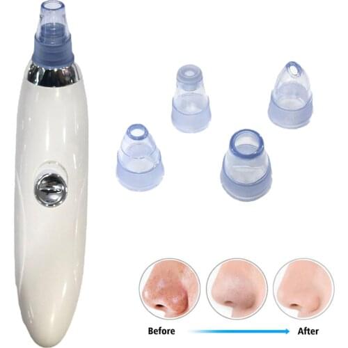 Blackhead Remover Pore Vacuum Cleaner Facial Pore Cleaner Electric Acne Extractor with 4 Probes Black Point Vacuum Cleaner Tool