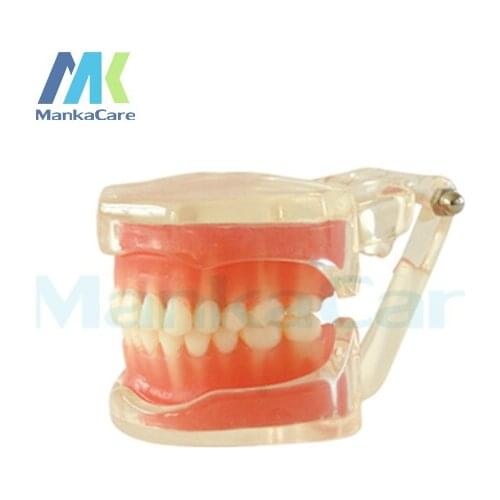 Manka Care - Removable Model/28pcs Tooth/Soft Gum/Without screw Oral Model Teeth Tooth Model