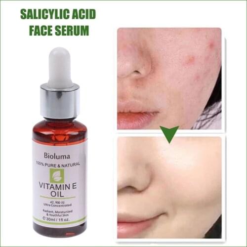 Vitamin E Oil Visibly Reduce Scars Stretch Marks Dark Spots & Wrinkles Remove Skin Essential Oil Pure Remove Ance Burn Scar