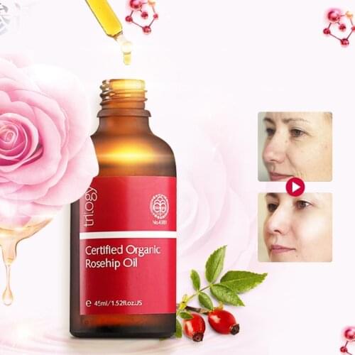 100%Original NewZealand Trilogy Certified Organic Rosehip Oil for Scars Fine lines Wrinkles Stretch marks Dehydrated Ageing skin