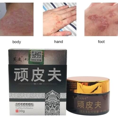 30g Herbal Skin Antibacterial Cream To Treat Skin Rashes Psoriasis Dermatitis Itching Repair Body Eczema Body Skin Health Care