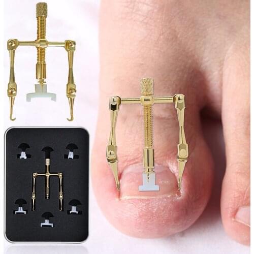 Alwafore Ingrown Toe Nail Correction Tool Fixer Recover Toe Paronychia Nail Brace Tools Ingrown Toenails Pedicure Tool