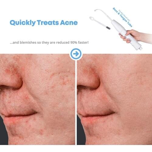 5 in 1 Electrode Wand High Frequency Skin Care Machine Acne Remover Device Heal Scar Enhance Blood Circulation Tool