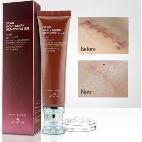 Acne Scar Removal Cream Skin Repair Face Cream Acne Spots Acne Treatment Blackhead Whitening Cream Stretch Marks 30ml