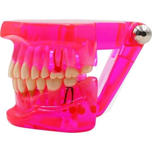1pc Dental Teeth Teaching Model Adult Pink Removable Tooth Orthodontic Standard Model For Patient Communication Study Model