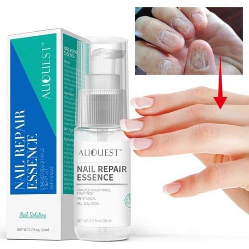 1 PCS Nail Repair Essence Foot Nail Fungus Removal Hand Foot Nail Care Infection Nail Treatment 20ml