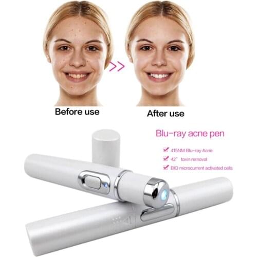 415nm Blue Light Laser Pen Scar Acne Removal Therapy Portable Acne Laser Pen Scar Wrinkle Removal Beauty Device Fast Delivery