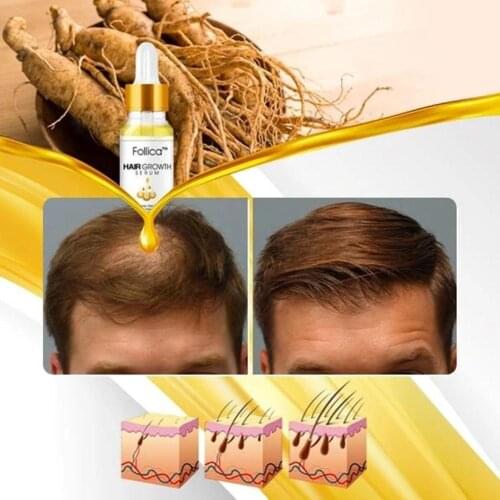 Unisex 20ml Hair Care Liquid Growth Serum Plant Extract Conditioner Ginger Shampoo Hair Conditioner Hair Serum Growth Solution