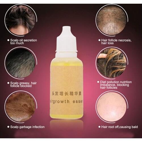 20ml Fast Hair Growth Fluid Increase Nutrition Hair Care Effective Hair Growth Ointment Fashion Hair Growth Essence Healthy