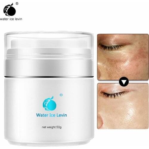 Anti-Pigment Chinese Face Whitening Cream Whitening Anti Freckle Dark Spot Remover Melasma Bleaching Skin Care Face Cream 50g
