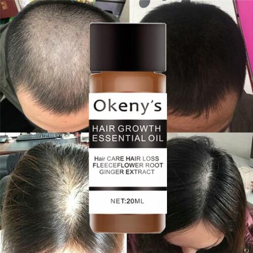 Okenys Fast Powerful Hair Growth Essence Products Essential Oil Liquid Treatment Preventing Hair Loss Hair Care Andrea 20ml
